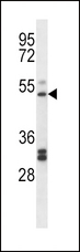 PTGIR / IP Receptor Antibody - PTGIR Antibody western blot of K562 cell line lysates (35 ug/lane). The PTGIR antibody detected the PTGIR protein (arrow).