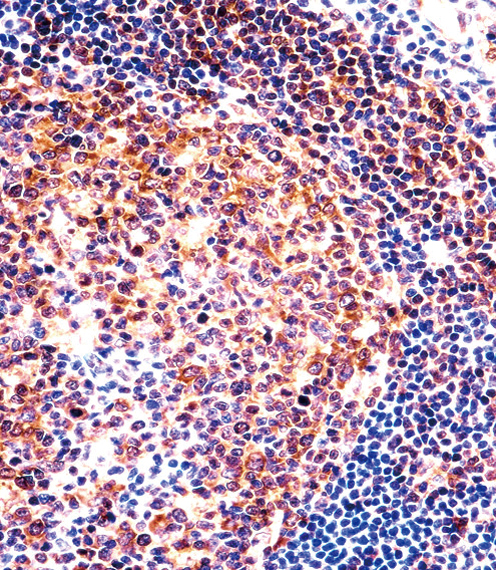 PTGIR / IP Receptor Antibody - PTGIR Antibody immunohistochemistry of formalin-fixed and paraffin-embedded human tonsil tissue followed by peroxidase-conjugated secondary antibody and DAB staining.