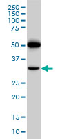 PTGIR / IP Receptor Antibody - PTGIR monoclonal antibody (M01), clone 4B10 Western blot of PTGIR expression in A-549.