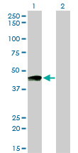 PTGIR / IP Receptor Antibody - Western blot of PTGIR expression in transfected 293T cell line by PTGIR monoclonal antibody (M01), clone 4B10.