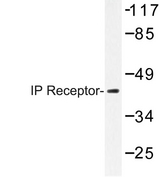 PTGIR / IP Receptor Antibody - Western blot of IP Receptor (H237) pAb in extracts from K562 cells.