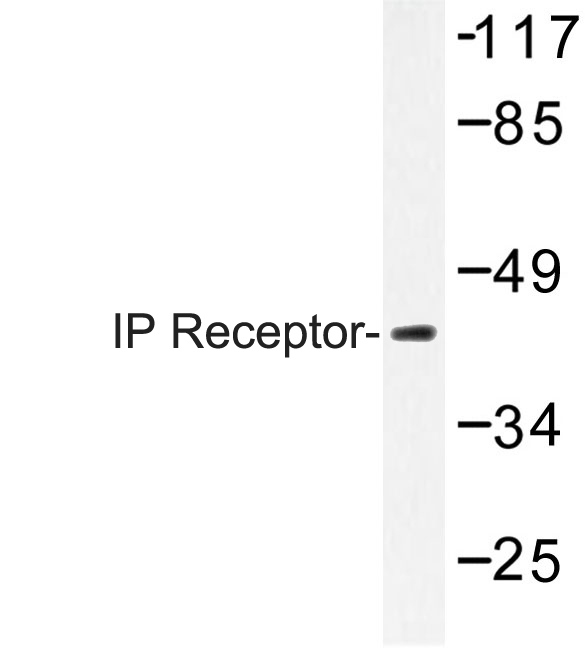 PTGIR / IP Receptor Antibody - Western blot of IP Receptor (H237) pAb in extracts from K562 cells.