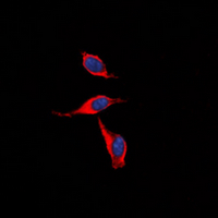 PTGIR / IP Receptor Antibody - Immunofluorescent analysis of IP Receptor staining in HeLa cells. Formalin-fixed cells were permeabilized with 0.1% Triton X-100 in TBS for 5-10 minutes and blocked with 3% BSA-PBS for 30 minutes at room temperature. Cells were probed with the primary antibody in 3% BSA-PBS and incubated overnight at 4 deg C in a humidified chamber. Cells were washed with PBST and incubated with a DyLight 594-conjugated secondary antibody (red) in PBS at room temperature in the dark. DAPI was used to stain the cell nuclei (blue).