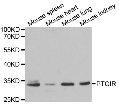 PTGIR / IP Receptor Antibody - Western blot analysis of extracts of various cell lines, using PTGIR antibody.