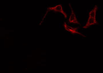 PTGIR / IP Receptor Antibody - Staining HeLa cells by IF/ICC. The samples were fixed with PFA and permeabilized in 0.1% Triton X-100, then blocked in 10% serum for 45 min at 25°C. The primary antibody was diluted at 1:200 and incubated with the sample for 1 hour at 37°C. An Alexa Fluor 594 conjugated goat anti-rabbit IgG (H+L) antibody, diluted at 1/600, was used as secondary antibody.