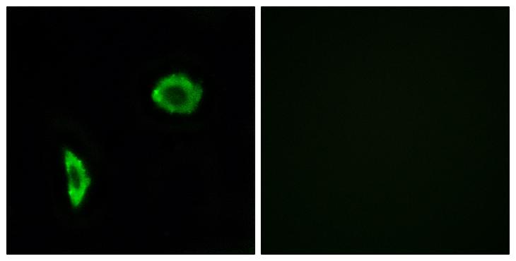 PTGIR / IP Receptor Antibody - Peptide - + Immunofluorescence analysis of LOVO cells, using Prostacyclin Receptor antibody.