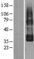 PTGIR / IP Receptor Protein - Western validation with an anti-DDK antibody * L: Control HEK293 lysate R: Over-expression lysate