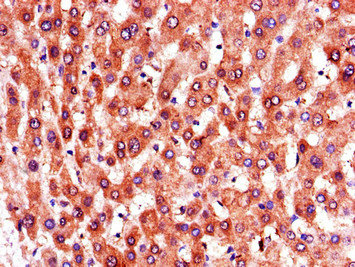 PTGR1 / LTB4DH Antibody - Immunohistochemistry of paraffin-embedded human liver tissue using PTGR1 Antibody at dilution of 1:100