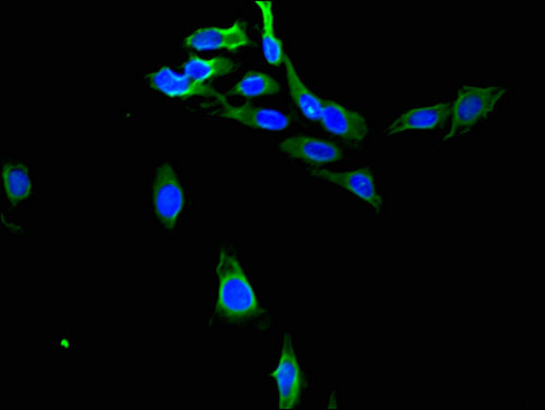 PTGR1 / LTB4DH Antibody - Immunofluorescent analysis of Hela cells using PTGR1 Antibody at a dilution of 1:100 and Alexa Fluor 488-congugated AffiniPure Goat Anti-Rabbit IgG(H+L)