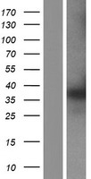 PTGR1 / LTB4DH Protein - Western validation with an anti-DDK antibody * L: Control HEK293 lysate R: Over-expression lysate
