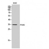 PTGR2 / PGR2 Antibody - Western blot of PTGR2 antibody