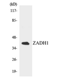 PTGR2 / PGR2 Antibody - Western blot analysis of the lysates from HepG2 cells using ZADH1 antibody.