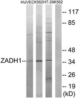 PTGR2 / PGR2 Antibody - Western blot analysis of lysates from K562, HUVEC, and HT-29 cells, using ZADH1 Antibody. The lane on the right is blocked with the synthesized peptide.