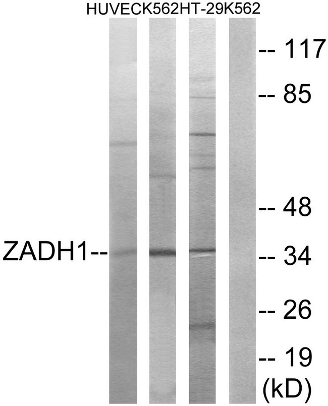 PTGR2 / PGR2 Antibody - Western blot analysis of lysates from K562, HUVEC, and HT-29 cells, using ZADH1 Antibody. The lane on the right is blocked with the synthesized peptide.
