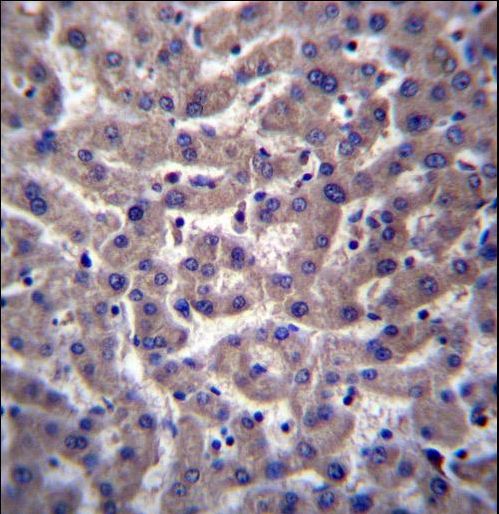 PTGR2 / PGR2 Antibody - PTGR2 Antibody immunohistochemistry of formalin-fixed and paraffin-embedded human liver tissue followed by peroxidase-conjugated secondary antibody and DAB staining.