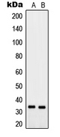 PTGR2 / PGR2 Antibody - Western blot analysis of PTGR2 expression in MCF7 (A); PC12 (B) whole cell lysates.