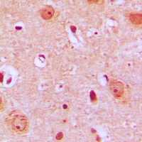 PTGR2 / PGR2 Antibody - Immunohistochemical analysis of PTGR2 staining in human brain formalin fixed paraffin embedded tissue section. The section was pre-treated using heat mediated antigen retrieval with sodium citrate buffer (pH 6.0). The section was then incubated with the antibody at room temperature and detected using an HRP conjugated compact polymer system. DAB was used as the chromogen. The section was then counterstained with hematoxylin and mounted with DPX.