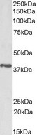 PTGR2 / PGR2 Antibody - Goat Anti-PTGR2 / ZADH1 Antibody (1µg/ml) staining of Pig Testis lysate (35µg protein in RIPA buffer). Primary incubation was 1 hour. Detected by chemiluminescencence.