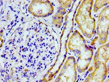 PTGR2 / PGR2 Antibody - Immunohistochemistry image of paraffin-embedded human kidney tissue at a dilution of 1:100