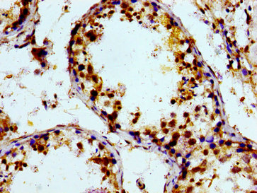PTGR2 / PGR2 Antibody - Immunohistochemistry image of paraffin-embedded human testis tissue at a dilution of 1:100