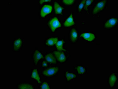 PTGR2 / PGR2 Antibody - Immunofluorescence staining of A549 cells with PTGR2 Antibody at 1:166, counter-stained with DAPI. The cells were fixed in 4% formaldehyde, permeabilized using 0.2% Triton X-100 and blocked in 10% normal Goat Serum. The cells were then incubated with the antibody overnight at 4°C. The secondary antibody was Alexa Fluor 488-congugated AffiniPure Goat Anti-Rabbit IgG(H+L).