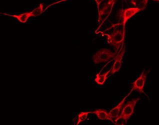 PTGR2 / PGR2 Antibody - Staining HeLa cells by IF/ICC. The samples were fixed with PFA and permeabilized in 0.1% Triton X-100, then blocked in 10% serum for 45 min at 25°C. The primary antibody was diluted at 1:200 and incubated with the sample for 1 hour at 37°C. An Alexa Fluor 594 conjugated goat anti-rabbit IgG (H+L) Ab, diluted at 1/600, was used as the secondary antibody.