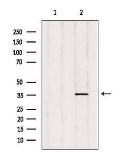 PTGR2 / PGR2 Antibody - Western blot analysis of extracts of rat heart tissue using ZADH1 antibody. Lane 1 was treated with the blocking peptide.