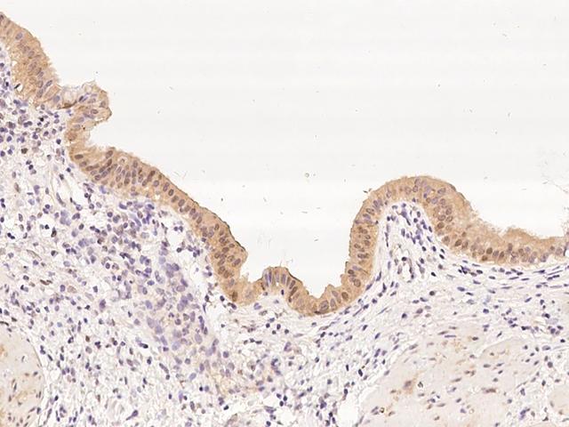 PTGR2 / PGR2 Antibody - Immunochemical staining of human PTGR2 in human gallbladder with rabbit polyclonal antibody at 1:500 dilution, formalin-fixed paraffin embedded sections.