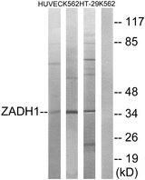 PTGR2 / PGR2 Antibody - Western blot analysis of extracts from HUVEC cells, K562 cells and HT-29 cells, using ZADH1 antibody.