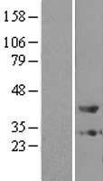 PTGR2 / PGR2 Protein - Western validation with an anti-DDK antibody * L: Control HEK293 lysate R: Over-expression lysate