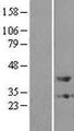 PTGR2 / PGR2 Protein - Western validation with an anti-DDK antibody * L: Control HEK293 lysate R: Over-expression lysate