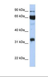 PTGS1 / COX-1 Antibody - Transfected 293T cell lysate. Antibody concentration: 1.0 ug/ml. Gel concentration: 12%.  This image was taken for the unconjugated form of this product. Other forms have not been tested.