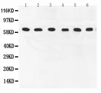 PTGS1 / COX-1 Antibody - WB of PTGS1 / COX1 / COX-1 antibody. All lanes: Anti-COX1 at 0.5ug/ml. Lane 1: Rat Brain Tissue Lysate at 40ug. Lane 2: HELA Whole Cell Lysate at 40ug. Lane 3: JURKAT Whole Cell Lysate at 40ug. Lane 4: K562 Whole Cell Lysate at 40ug. Lane 5: MCF-7 Whole Cell Lysate at 40ug. Lane 6: A549 Whole Cell Lysate at 40ug. Predicted bind size: 69KD. Observed bind size: 69KD.
