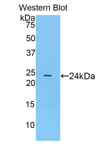 PTGS1 / COX-1 Antibody - Western blot of recombinant PTGS1 / COX1 / COX-1.  This image was taken for the unconjugated form of this product. Other forms have not been tested.