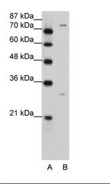 PTGS1 / COX-1 Antibody - A: Marker, B: Jurkat Cell Lysate.  This image was taken for the unconjugated form of this product. Other forms have not been tested.