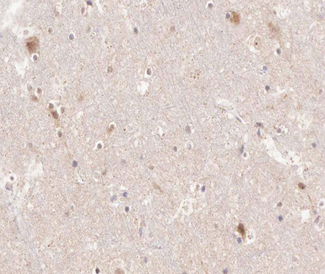 PTGS1 / COX-1 Antibody - 1:200 staining human brain tissue by IHC-P. The tissue was formaldehyde fixed and a heat mediated antigen retrieval step in citrate buffer was performed. The tissue was then blocked and incubated with the antibody for 1.5 hours at 22°C. An HRP conjugated goat anti-rabbit antibody was used as the secondary.