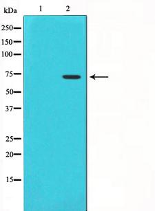 PTGS1 / COX-1 Antibody - Western blot analysis on HuvEc cell lysates using Cox1 antibody. The lane on the left is treated with the antigen-specific peptide.