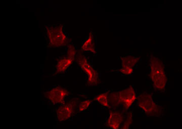 PTGS1 / COX-1 Antibody - Staining HuvEc cells by IF/ICC. The samples were fixed with PFA and permeabilized in 0.1% Triton X-100, then blocked in 10% serum for 45 min at 25°C. The primary antibody was diluted at 1:200 and incubated with the sample for 1 hour at 37°C. An Alexa Fluor 594 conjugated goat anti-rabbit IgG (H+L) Ab, diluted at 1/600, was used as the secondary antibody.