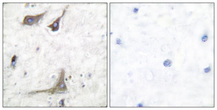 PTGS1 / COX-1 Antibody - Peptide - + Immunohistochemical analysis of paraffin-embedded human brain tissue using COX1 antibody.