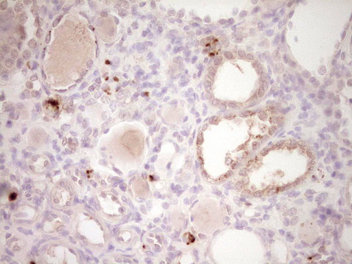 PTGS2 / COX2 / COX-2 Antibody - IHC of paraffin-embedded Human Kidney tissue using anti-PTGS2 mouse monoclonal antibody. (Heat-induced epitope retrieval by 1 mM EDTA in 10mM Tris, pH8.5, 120°C for 3min).