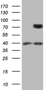 PTGS2 / COX2 / COX-2 Antibody - HEK293T cells were transfected with the pCMV6-ENTRY control. (Left lane) or pCMV6-ENTRY PTGS2. (Right lane) cDNA for 48 hrs and lysed. Equivalent amounts of cell lysates. (5 ug per lane) were separated by SDS-PAGE and immunoblotted with anti-PTGS2.