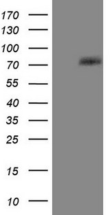 PTGS2 / COX2 / COX-2 Antibody - HEK293T cells were transfected with the pCMV6-ENTRY control (Left lane) or pCMV6-ENTRY PTGS2 (Right lane) cDNA for 48 hrs and lysed. Equivalent amounts of cell lysates (5 ug per lane) were separated by SDS-PAGE and immunoblotted with anti-PTGS2.