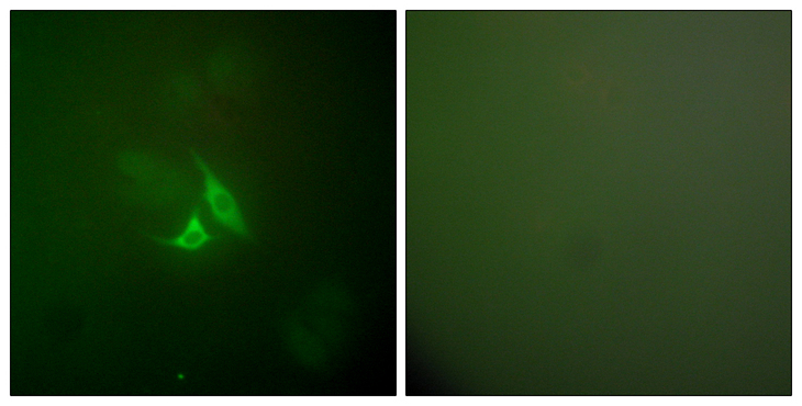 PTGS2 / COX2 / COX-2 Antibody - Immunofluorescence analysis of A549 cells, using Cox2 Antibody. The picture on the right is blocked with the synthesized peptide.