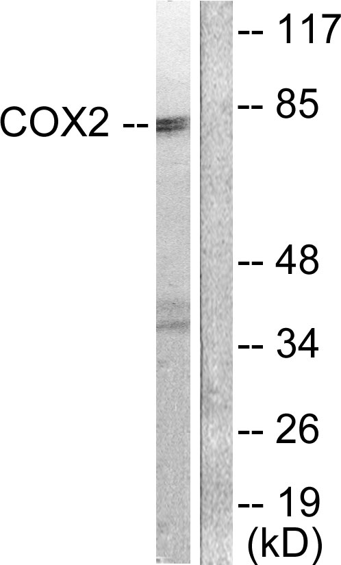 PTGS2 / COX2 / COX-2 Antibody - Western blot analysis of lysates from A549 cells, using Cox2 Antibody. The lane on the right is blocked with the synthesized peptide.