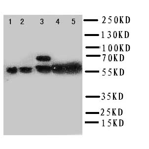 PTGS2 / COX2 / COX-2 Antibody - WB of PTGS2 / COX2 / COX-2 antibody. Lane 1: Human Placenta Tissue Lysate. Lane 2: COLO320 Cell Lysate. Lane 3: HELA Cell Lysate. Lane 4: PANC Cell Lysate. Lane 5: SKOV Cell Lysate.