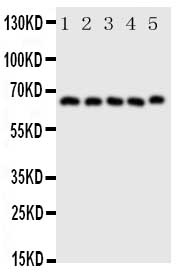 PTGS2 / COX2 / COX-2 Antibody - Anti-COX2/Cyclooxygenase 2 antibody, Western blotting All lanes: Anti COX2/Cyclooxygenase 2 at 0.5ug/ml Lane 1: Human Placenta Tissue Lysate at 50ug Lane 2: COLO320 Whole Cell Lysate at 40ug Lane 3: HELA Whole Cell Lysate at 40ug Lane 4: PANC Whole Cell Lysate at 40ug Lane 5: SKOV Whole Cell Lysate at 40ug Predicted bind size: 69KD Observed bind size: 69KD