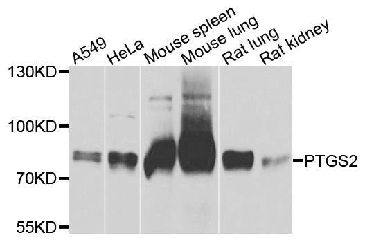 PTGS2 / COX2 / COX-2 Antibody - Western blot analysis of extracts of various cell lines, using PTGS2 antibody at 1:1000 dilution. The secondary antibody used was an HRP Goat Anti-Rabbit IgG (H+L) at 1:10000 dilution. Lysates were loaded 25ug per lane and 3% nonfat dry milk in TBST was used for blocking. An ECL Kit was used for detection and the exposure time was 3s.