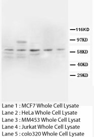 PTGS2 / COX2 / COX-2 Antibody -  This image was taken for the unconjugated form of this product. Other forms have not been tested.