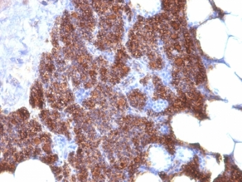 PTH / Parathyroid Hormone Antibody - Formalin-fixed, paraffin-embedded human parathyroid stained with PTH antibody (3H9 + PTH/1175).  This image was taken for the unmodified form of this product. Other forms have not been tested.