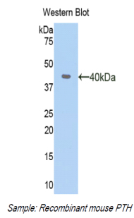 PTH / Parathyroid Hormone Antibody - Western blot of recombinant Parathyroid Hormone / PTH.  This image was taken for the unconjugated form of this product. Other forms have not been tested.